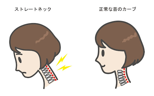 正しい姿勢とストレートネック